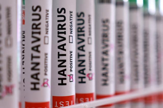 Türkiye'de hantavirüs vakası var mı? Sağlık Bakanlığı'ndan açıklama