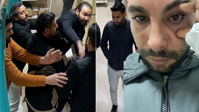 Rapor isteyen hastaya yumruk attı yüzde 30 görme kaybına neden oldu. Doktora 2,5 yıla kadar hapis istemi